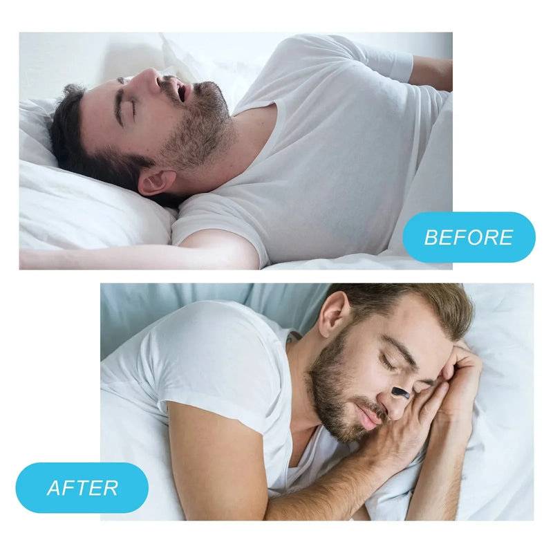 Dilatadores de respiração nasal